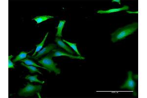 Immunofluorescence of purified MaxPab antibody to FBXO42 on HeLa cell. (FBXO42 Antikörper  (AA 1-716))
