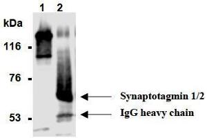 Western Blotting (WB) image for anti-Synaptotagmin I (SYT1) antibody (ABIN1109184) (SYT1 Antikörper)