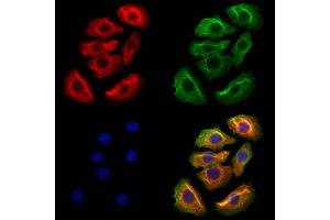 ABIN6262304 and ABIN6272944 staining Hela cells by IF/ICC. (HMGCS1 Antikörper  (Internal Region))