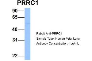 Host: Rabbit  Target Name: PRRC1  Sample Tissue: Human Fetal Lung  Antibody Dilution: 1. (PRRC1 Antikörper  (Middle Region))