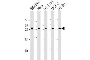 Western Blot at 1:2000 dilution Lane 1: SK-BR-3 whole cell lysate Lane 2: Hela whole cell lysate Lane 3: HCT116 whole cell lysate Lane 4: MCF-7 whole cell lysate Lane 5: HL-60 whole cell lysate Lysates/proteins at 20 ug per lane. (NAA10 Antikörper  (AA 135-167))