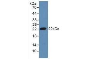 Detection of Recombinant ADM, Mouse using Polyclonal Antibody to Adrenomedullin (ADM) (Adrenomedullin Antikörper  (AA 24-171))