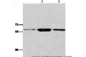 Western Blot analysis of K562,231,Human fetal liver tissue using GPC6 Polyclonal Antibody at dilution of 1:700 (Glypican 6 Antikörper)