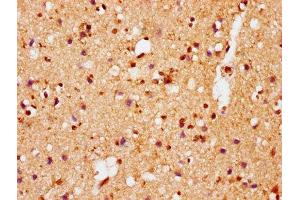 IHC image of ABIN7127752 diluted at 1:100 and staining in paraffin-embedded human brain tissue performed on a Leica BondTM system. (Rekombinanter SNCA Antikörper  (pSer129))