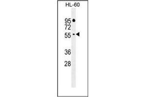 Western Blotting (WB) image for anti-F-Box and WD Repeat Domain Containing 11 (FBXW11) (AA 175-204), (Middle Region) antibody (ABIN952276)