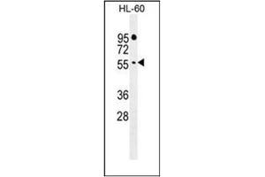 Western blot analysis of FBXW11 Antibody (Center) in HL-60 cell line lysates (35ug/lane). (FBXW11 Antikörper  (Middle Region))