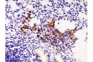 Paraformaldehyde-fixed, paraffin embedded rat lung, Antigen retrieval by boiling in sodium citrate buffer (pH6) for 15min, Block endogenous peroxidase by 3% hydrogen peroxide for 30 minutes, Blocking buffer (normal goat serum) at 37°C for 20min, Antibody incubation with	Rabbit Anti-ABCD1/CCL22 Polyclonal Antibody, Unconjugated  at 1:500 overnight at 4°C, followed by a conjugated secondary for 90 minutes and DAB staining. (CCL22 Antikörper  (AA 51-93))