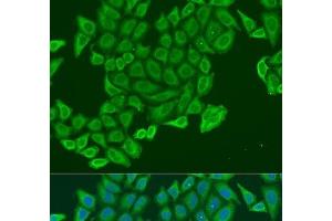 Immunofluorescence analysis of U2OS cells using EXOC2 Polyclonal Antibody at dilution of 1:100. (EXOC2 Antikörper)