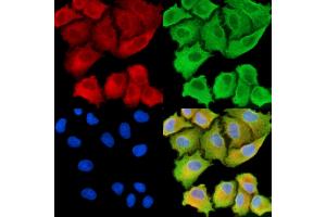 ABIN7094981 and ABIN7099037 staining  cells by IF/ICC. (ANKH Antikörper)
