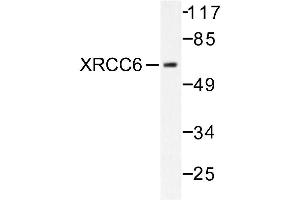 Image no. 1 for anti-X-Ray Repair Complementing Defective Repair in Chinese Hamster Cells 6 (XRCC6) antibody (ABIN271984) (XRCC6 Antikörper)