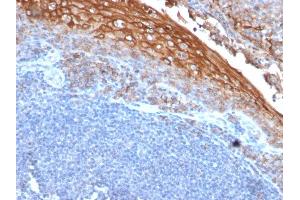 Formalin-fixed, paraffin-embedded human Tonsil stained with MUC18 Mouse Monoclonal Antibody (MUC18/1130). (MCAM Antikörper)