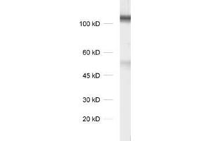 dilution 1 : 1000, sample: synaptic membrane fraction of rat brain (LP1) (DLG3 Antikörper)