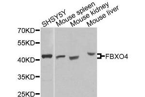 Western blot analysis of extracts of various cell lines, using FBXO4 antibody (ABIN6003676) at 1/1000 dilution. (FBXO4 Antikörper)