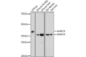 Western blot analysis of extracts of various cell lines, using AMACR antibody (ABIN3021497, ABIN3021498, ABIN3021499 and ABIN6215153) at 1:1000 dilution. (AMACR Antikörper  (AA 1-198))