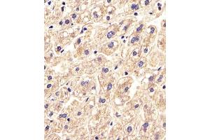 (ABIN654868 and ABIN2844526) staining SLC16A11 in Human liver tissue sections by Immunohistochemistry (IHC-P - paraformaldehyde-fixed, paraffin-embedded sections).