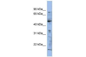 RAB3IP antibody used at 1 ug/ml to detect target protein. (RAB3IP Antikörper)