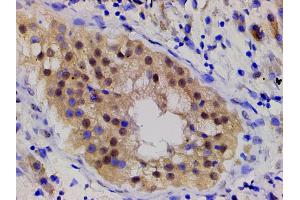 Immunohistochemistry (IHC) image for anti-LIM Domain Kinase 1 (LIMK1) (pThr508) antibody (ABIN6255701)