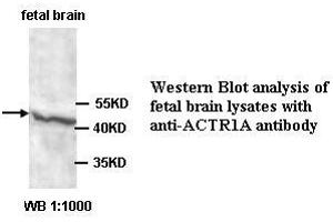 Image no. 1 for anti-Alpha Centractin (ACTR1A) antibody (ABIN1574449) (ACTR1A Antikörper)