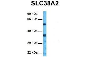 Host:  Rabbit  Target Name:  SLC38A2  Sample Tissue:  Human HepG2  Antibody Dilution:  1. (SLC38A2 Antikörper  (N-Term))