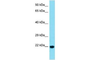 Host:  Rabbit  Target Name:  BTBD2  Sample Type:  Esophagus Tumor lysates  Antibody Dilution:  1.