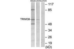 Western blot analysis of extracts from LOVO/RAW264. (TRIM38 Antikörper  (AA 161-210))