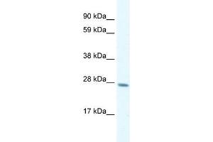 Human Liver; WB Suggested Anti-GTF2F2 Antibody Titration: 0.