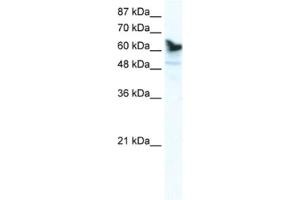 Western Blotting (WB) image for anti-DEAD (Asp-Glu-Ala-Asp) Box Polypeptide 41 (DDX41) antibody (ABIN2461350)