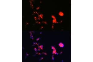 Immunofluorescence analysis of SH-SY5Y cells using DKK3 Rabbit mAb (ABIN1680063, ABIN3018243, ABIN3018244 and ABIN7101586) at dilution of 1:100 (40x lens). (DKK3 Antikörper)