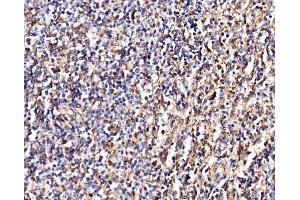 IHC analysis of MPPB/PMPCB using anti-MPPB/PMPCB antibody (ABIN7600758). (PMPCB Antikörper  (AA 23-479))