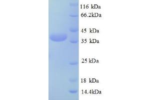 SDS-PAGE (SDS) image for Testis Expressed 12 (TEX12) (AA 1-123), (full length) protein (GST tag) (ABIN5710474) (TEX12 Protein (AA 1-123, full length) (GST tag))