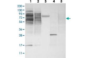 Western blot analysis of Lane 1: RT-4, Lane 2: U-251 MG, Lane 3: Human Plasma, Lane 4: Liver, Lane 5: Tonsil with ZSCAN2 polyclonal antibody .
