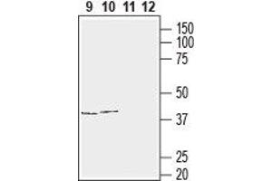 Western blot analysis of human T-cell leukemia (Jurkat) (lanes 9 and 11) and human neuroblastoma (SH-SY5Y) (lanes 10 and 12) cell line lysates:9,10. (Gap Junction Protein, alpha 1, 43kDa (GJA1) Peptid)