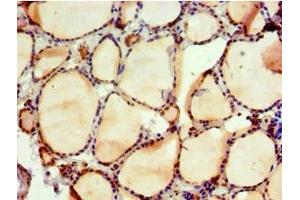Immunohistochemistry of paraffin-embedded human thyroid tissue using ABIN7161554 at dilution of 1:100 (NAB2 Antikörper  (AA 1-200))