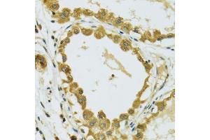 Immunohistochemistry (Paraffin-embedded Sections) (IHC (p)) image for anti-Ribosomal Protein S7 (RPS7) (AA 1-194) antibody (ABIN6147244)