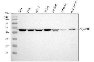 Western blot analysis of SQSTM1 using anti-SQSTM1 antibody (ABIN3043937). (SQSTM1 Antikörper  (N-Term))