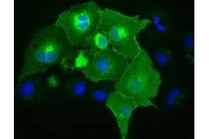 Anti-CD5 mouse monoclonal antibody (ABIN2452892) immunofluorescent staining of COS7 cells transiently transfected by pCMV6-ENTRY CD5 (RC206494). (CD5 Antikörper)