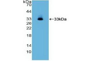 Detection of Recombinant ITGa2, Human using Polyclonal Antibody to Integrin Alpha 2 (ITGa2) (ITGA2 Antikörper  (AA 678-894))