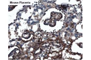 Mouse placenta (KISS1R Antikörper  (AA 375-398))
