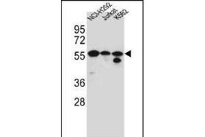 FOXN2 Antibody (N-term) (ABIN656184 and ABIN2845513) western blot analysis in NCI-,Jurkat,K562 cell line lysates (35 μg/lane).