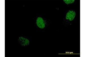 Immunofluorescence of monoclonal antibody to NEUROG1 on HeLa cell. (Neurogenin 1 Antikörper  (AA 82-163))