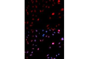 Immunofluorescence analysis of MCF-7 cells using Phospho-CDK1-Y15 antibody (ABIN5969877). (CDK1 Antikörper  (pTyr15))