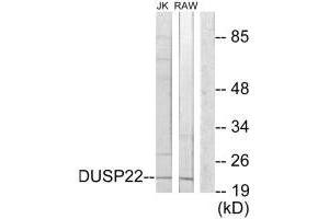 Western blot analysis of extracts from Jurkat cells and RAW264. (DUSP22 Antikörper)