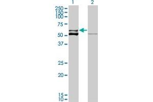 Western Blot analysis of GLUD2 expression in transfected 293T cell line by GLUD2 monoclonal antibody (M01), clone 3C2. (GLUD2 Antikörper  (AA 1-264))