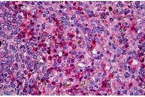 Immunohistochemistry (Paraffin-embedded Sections) (IHC (p)) image for anti-Chemokine (C-C Motif) Receptor 1 (CCR1) (AA 7-24), (Extracellular Domain), (N-Term) antibody (ABIN1105986)