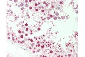 Anti-MEN1 / MENIN antibody IHC staining of human testis.