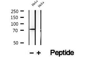 Western blot analysis of extracts of HeLa cells, using TBC1D23 antibody. (TBC1D23 Antikörper  (Internal Region))