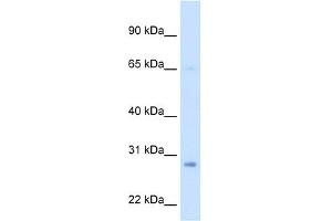 WB Suggested Anti-ECHS1 Antibody Titration:  2. (ECHS1 Antikörper  (Middle Region))