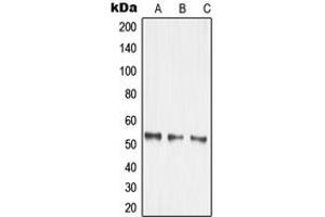 Western blot analysis of MMP14 expression in HEK293T (A), mouse kidney (B), rat brain (C) whole cell lysates. (MMP14 Antikörper  (Center))