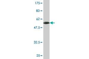 Western Blot detection against Immunogen (57. (RHOXF2 Antikörper  (AA 1-288))