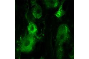 IF on rat trigeminal using Mouse monoclonal antibody to rat p75NTR  at a concentration of 10 µg/ml.